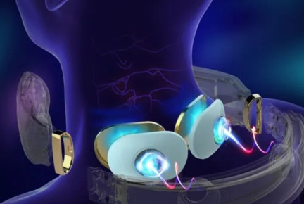 Định nghĩa TENS là gì? Ứng dụng TENS trong máy massage