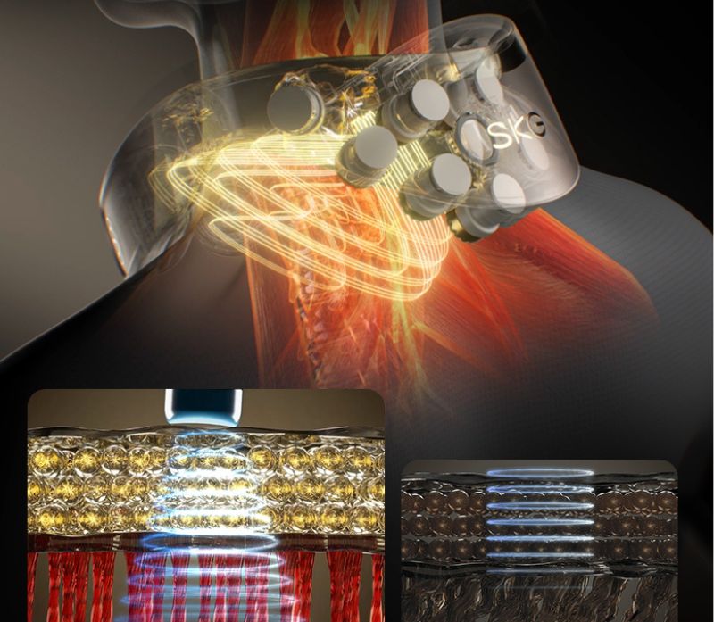 Xung điện ems là gì? Đặc điểm của công nghệ EMS