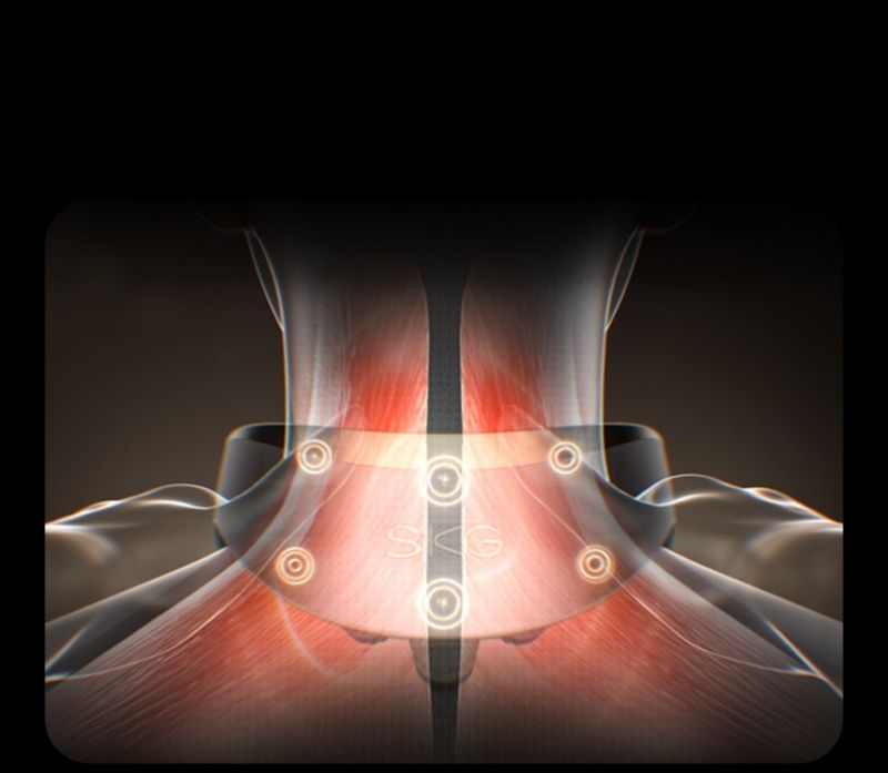 Đặc điểm của công nghệ EMS