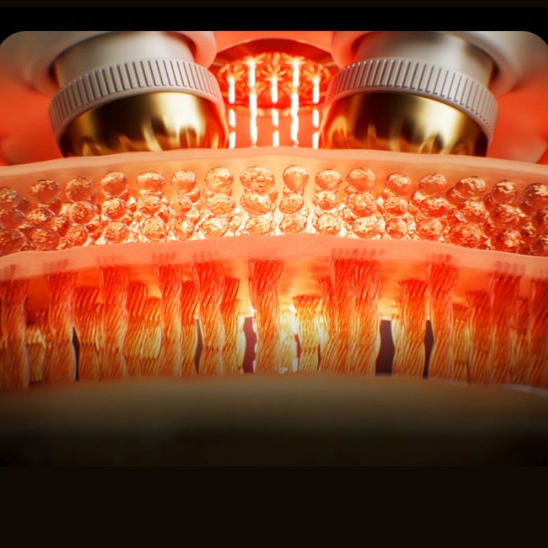 Chườm ấm hồng ngoại giúp thư giãn cơ nhanh chóng