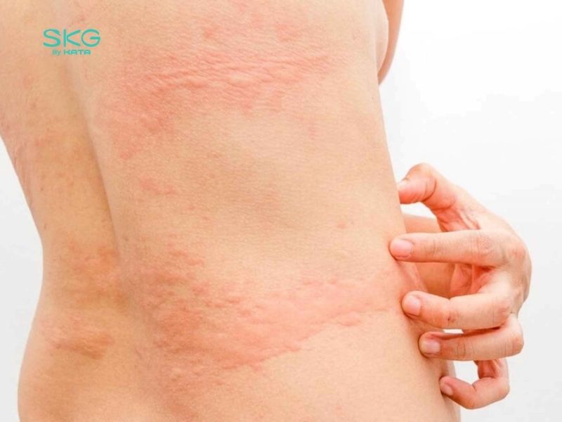 Dùng máy massage bị ngứa thường do tăng tuần hoàn máu, kích thích dây thần kinh dưới da, hoặc do da bị kích ứng
