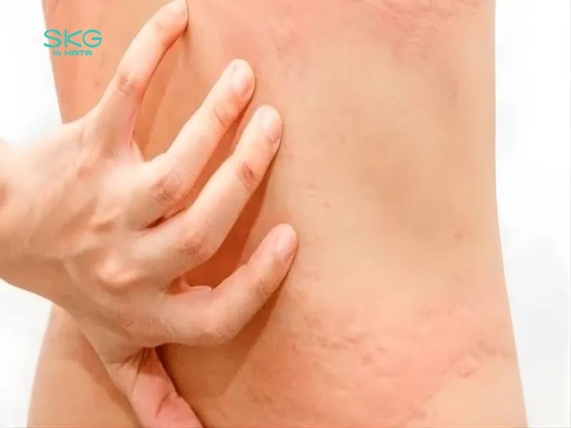 Nếu xuất hiện các triệu chứng đau tăng lên, sưng nề, tê bì hoặc có dấu hiệu tổn thương nặng